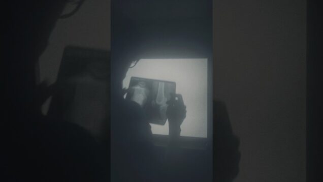 from fracture to particles #touchdesigner #abletonlive #davinciresolve #xray