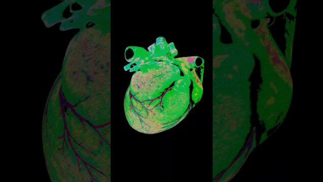 Glitch Heart | Human Heart | 3D | Future Trap Beat | LML by DEEETEEE #touchdesigner #heart